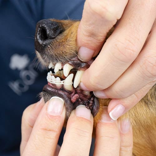 TOOTH CORRECTIVE BAND - 50 cm