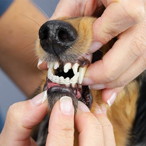 TOOTH CORRECTIVE BAND - 50 cm