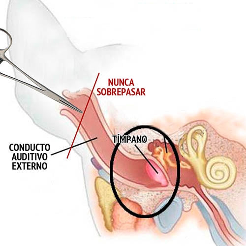 MULTIPURPOSE FORCEPS